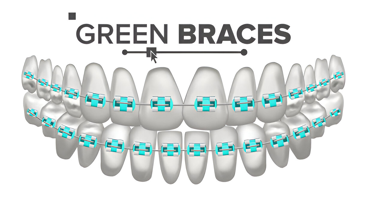 Potential of Dental Implants