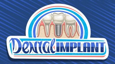 6 Warning Signs of a Failed Dental Implant