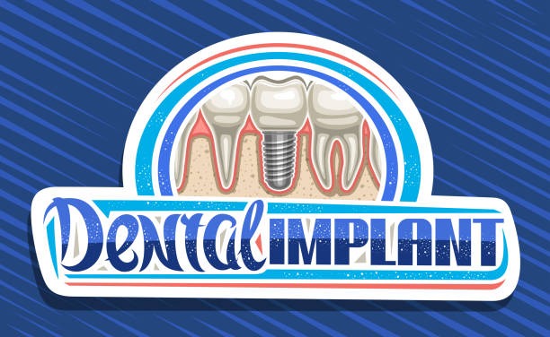 6 Warning Signs of a Failed Dental Implant