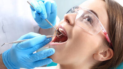 Root Canal Treatments